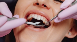 does everyone get wisdom teeth