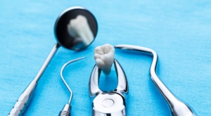 what to do after a tooth extraction