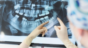 recommended frequency of dental x rays