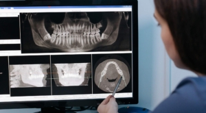 root-canal-treatment with tooth decay